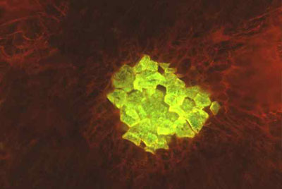 석세포 형광사진